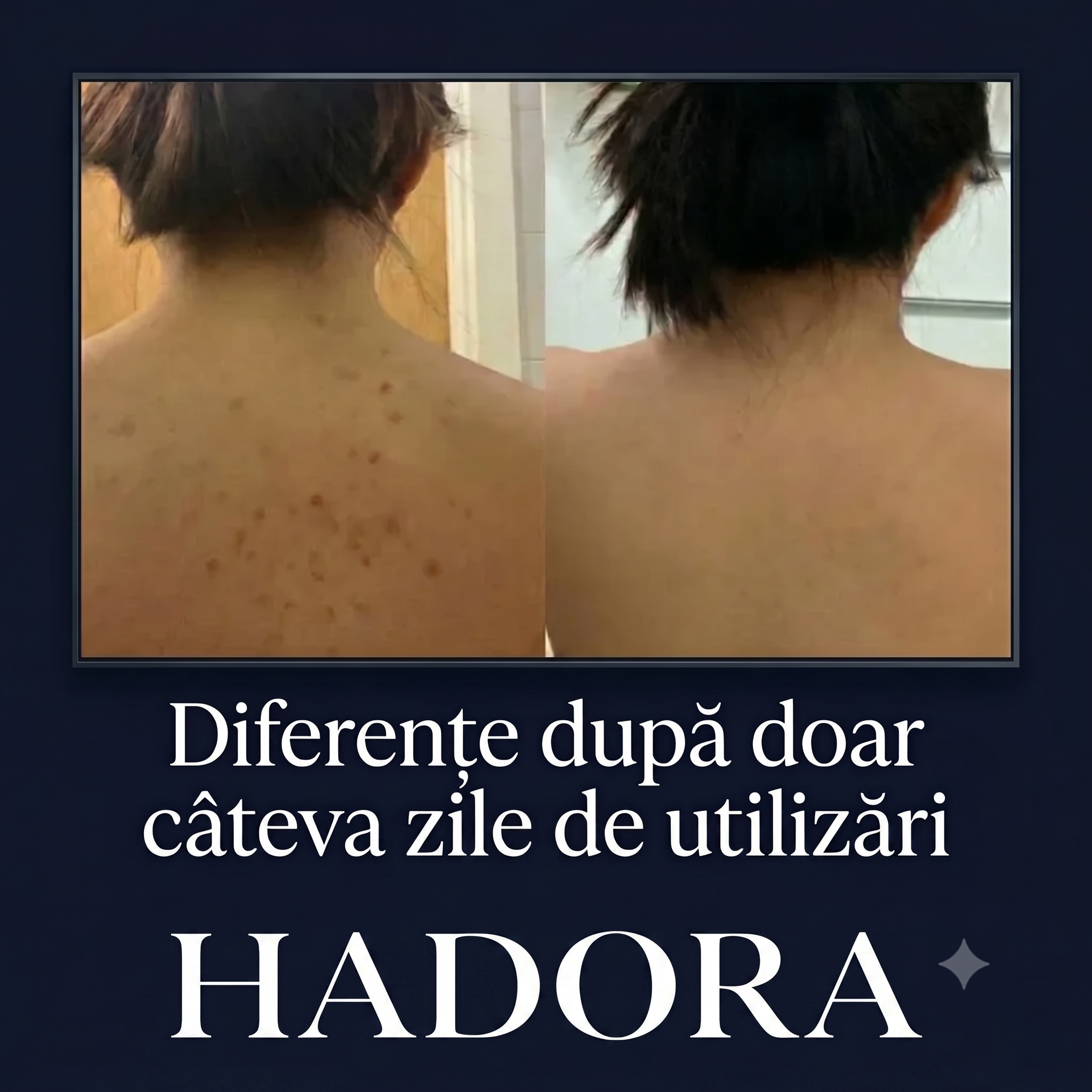 HADORA – Prosop Exfoliant Antibacterian pentru Duș