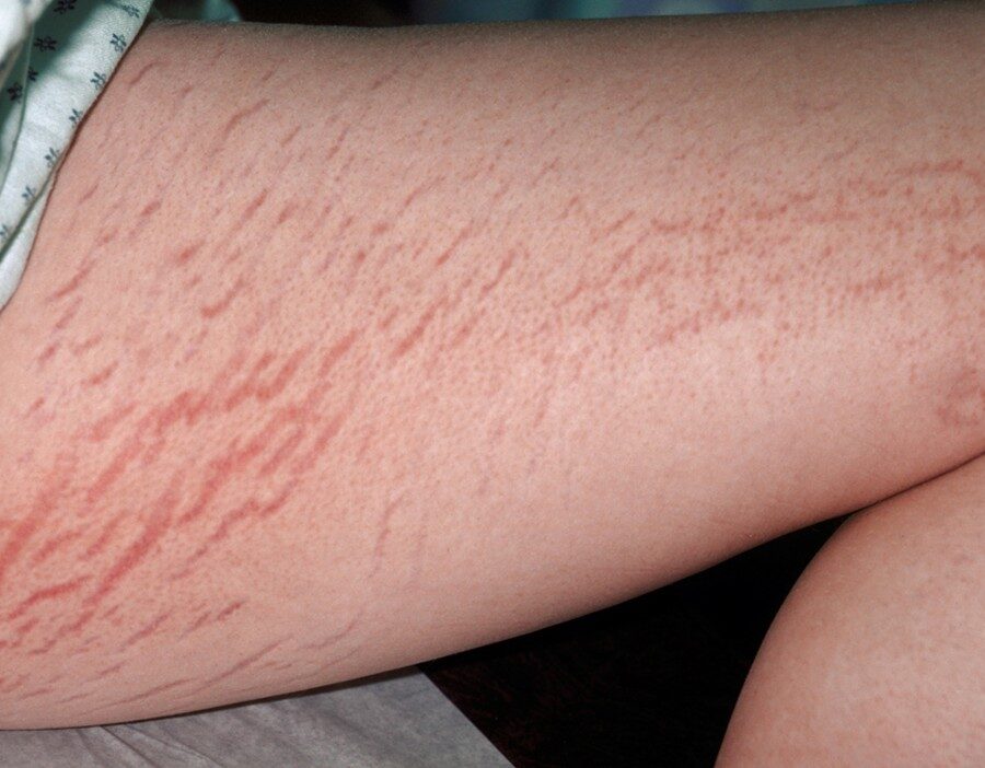 CREMA VERGETURI